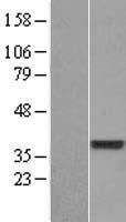 DUS4L Human Over-expression Lysate
