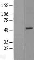 KRT26 Human Over-expression Lysate