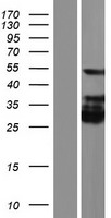 KRT28 Human Over-expression Lysate