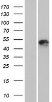 KRT25 Human Over-expression Lysate
