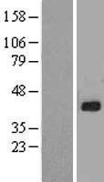 GJA5 Human Over-expression Lysate