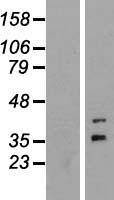 FOXR1 Human Over-expression Lysate