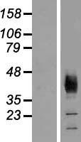 SLC36A2 Human Over-expression Lysate