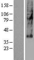 SLC46A3 Human Over-expression Lysate