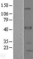 SPRED2 Human Over-expression Lysate