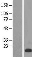 UBE2D2 Human Over-expression Lysate