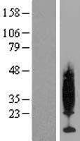 PKIG Human Over-expression Lysate
