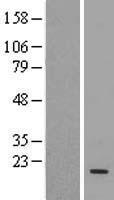 UBE2D3 Human Over-expression Lysate