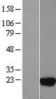 UBE2D3 Human Over-expression Lysate