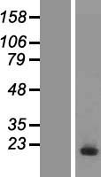 UBE2D3 Human Over-expression Lysate