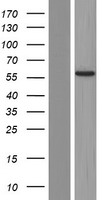ANKS1B Human Over-expression Lysate