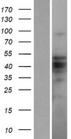 ZBTB12 Human Over-expression Lysate