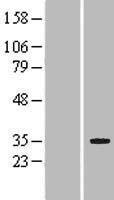 LRP5L Human Over-expression Lysate