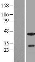 THAP5 Human Over-expression Lysate
