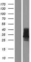 C1QL2 Human Over-expression Lysate