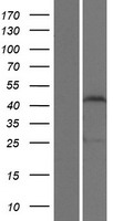 ZSCAN1 Human Over-expression Lysate