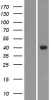 GDPD1 Human Over-expression Lysate