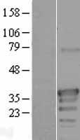 ODF3L2 Human Over-expression Lysate