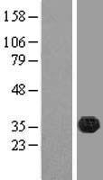 FAM70B (TMEM255B) Human Over-expression Lysate