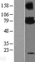 UBE2G2 Human Over-expression Lysate