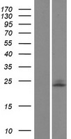 UBE2E1 Human Over-expression Lysate