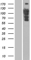 DLC1 Human Over-expression Lysate