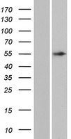 ANKDD1A Human Over-expression Lysate