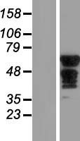 SLC6A18 Human Over-expression Lysate