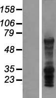LAT2 (SLC7A8) Human Over-expression Lysate