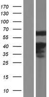 CREB5 Human Over-expression Lysate