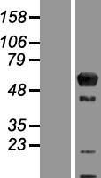 ARL13B Human Over-expression Lysate