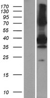 SNX20 Human Over-expression Lysate