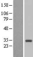 CCNB1IP1 Human Over-expression Lysate