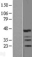 IBRDC2 (RNF144B) Human Over-expression Lysate