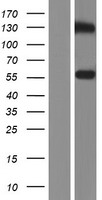STEAP3 Human Over-expression Lysate