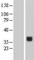 CLEC10A Human Over-expression Lysate