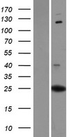 PXDC1 Human Over-expression Lysate