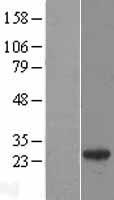 RAB27A Human Over-expression Lysate