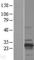 RD3 Human Over-expression Lysate