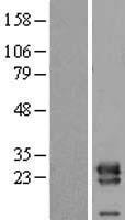 VPS28 Human Over-expression Lysate