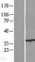 FBXO25 Human Over-expression Lysate