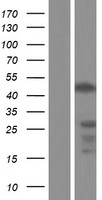 IKZF3 Human Over-expression Lysate