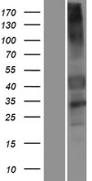 GPCR 2037 (GPR151) Human Over-expression Lysate