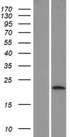 LYPD6 Human Over-expression Lysate
