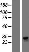 Dectin 1 (CLEC7A) Human Over-expression Lysate