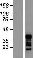 RNF126 Human Over-expression Lysate
