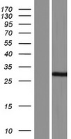 LOC285498 (RNF212) Human Over-expression Lysate