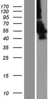 LDHD Human Over-expression Lysate