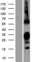 RBPMS2 Human Over-expression Lysate