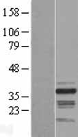 RNF41 Human Over-expression Lysate